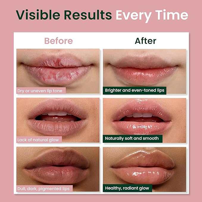 Vegan Lip Balm for Dull, Dark & Smokers' Lips | Naturally – Hydrating & Moisturizing - Antioxidant-Rich-VivaGrace Women