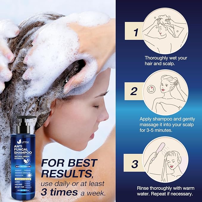 Anti-Fungal Shampoo for Scalp Psoriasis: Dandruff Shampoo for Folliculitis and Seborrheic Dermatitis - Relieves Itchy & Dry Scalp - 300 mL / 10.1 fl.oz-VivaGrace Women