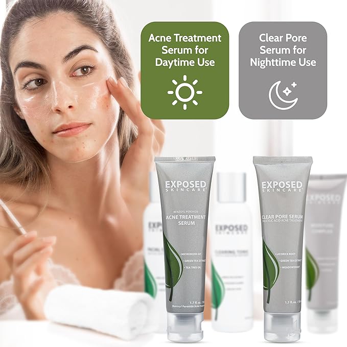 Exposed Skin Care Expanded Acne Treatment Kit - Includes Salicylic Acid Face Wash, Clearing Tonic, Treatment Serum with Benzoyl Peroxide, Clear Pore Serum, Moisture Complex - Made for All Skin Types-VivaGrace Women