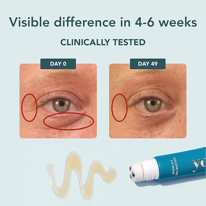 YOURS Eye Serum with Caffeine & Antioxidants | Hydrates and Brightens Under Eye Area | Restores Skin Firmness and Reduces Appearance of Fine Lines-VivaGrace Women