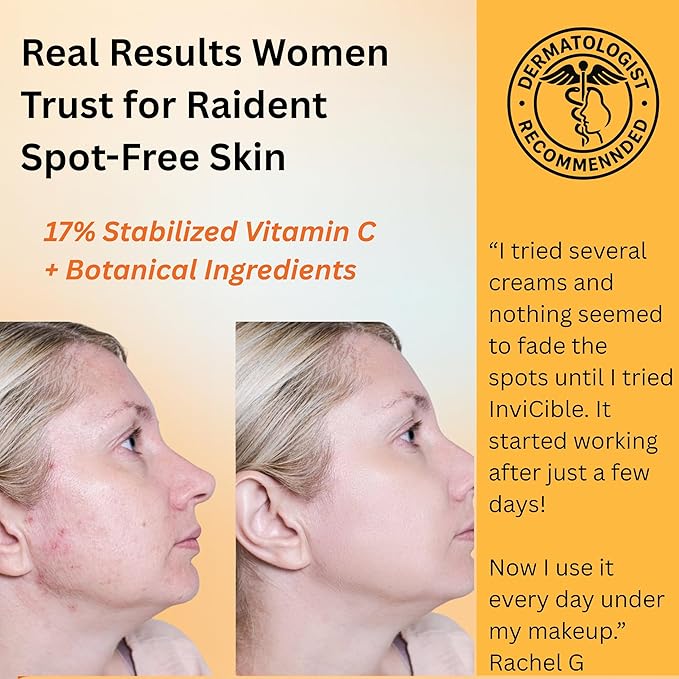 5 in 1 Primer For Face Before Makeup | 17% Vitamin C | All Day Grip | Dark Spot Corrector | Silky Matt Finish | Chemical Free | Vegan | All Skin Types | Made in America | 1fl oz-VivaGrace Women