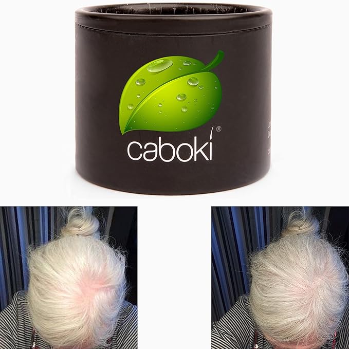 Hair Thickening Fibers. Cover Bald Spot and Thinning Hair Instantly. Make Thin Hair Look 10X Fuller. All-Natural Hair Building Fiber. Trial Size (10-Day Supply). Silver/White-VivaGrace Women