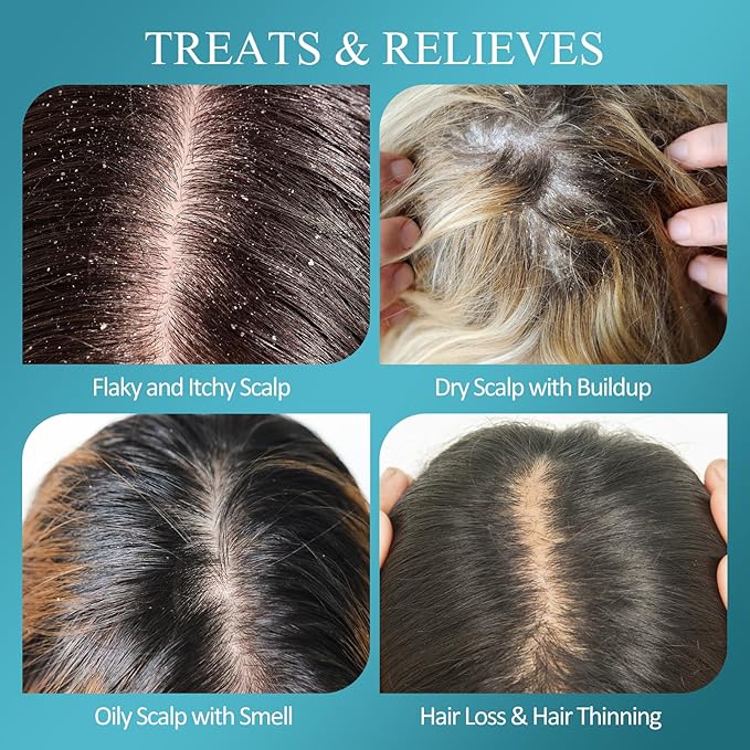 Scalp Scrub, Biotin 2-in-1 Scalp Exfoliator Scrub Clarifying Detox Shampoo with 3% Salicylic Acid & Tea Tree for Dandruff, Build Up, Itchy Scalp, Oily Hair & Dry Scalp Treatment with Scalp Massager-VivaGrace Women