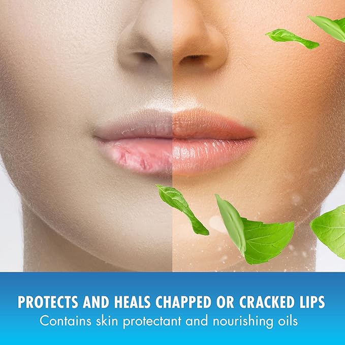 Natural Ice Original SPF 15 Medicated Lip Balm - 12 Count Pack-VivaGrace Women