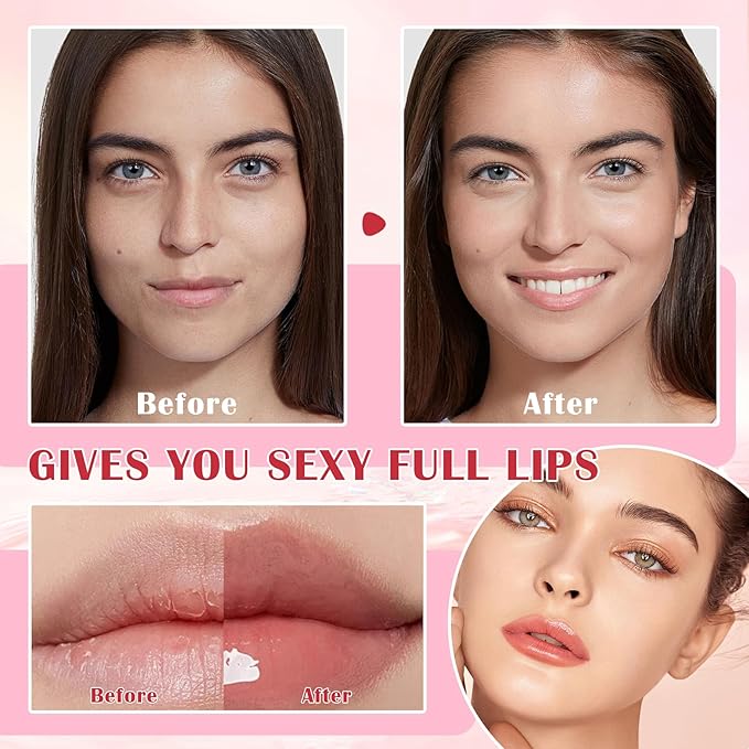 Honey Lip Balm (Strawberry, Watermelon) - Smooth, Hydrating Propolis Lip Mask Overnight Scrubs Exfoliator, Natural Ingredients, Lip Care Set-VivaGrace Women