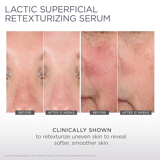 Glytone Micro-Peel Lactic Superficial Retexturizing Serum | Anti-Aging AHA Exfoliating Serum for Face with 10% Lactic Acid | Hydrates, Brightens & Reduces Wrinkles | Paraben-Free - 1 Fl oz-VivaGrace Women
