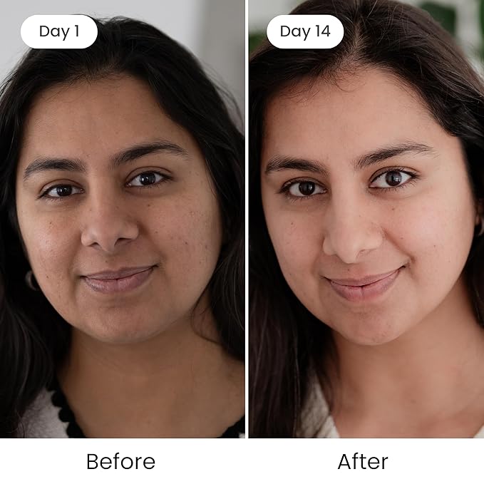 Shankara Kumkumadi Oil with Pure Saffron and Ayurvedic Herbs (Rose Aroma 18ml)-VivaGrace Women