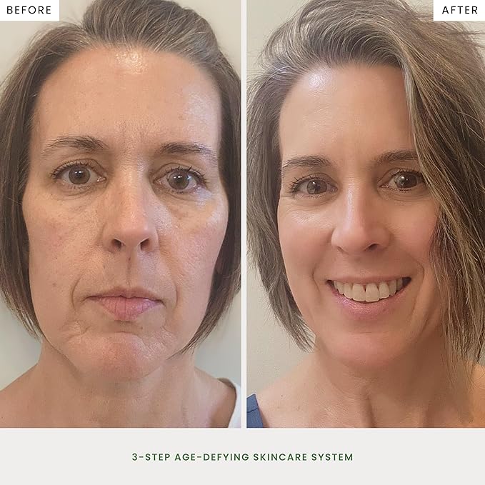 The Spa Dr. 3-Step Age-Defying Skincare System - Antiaging SkinCare Set for Women - Anti Aging Skin Care Sets for Women - Skin Care Routine: Cleanser, Age Defying Lift & Tight Serum, Moisturizer-VivaGrace Women