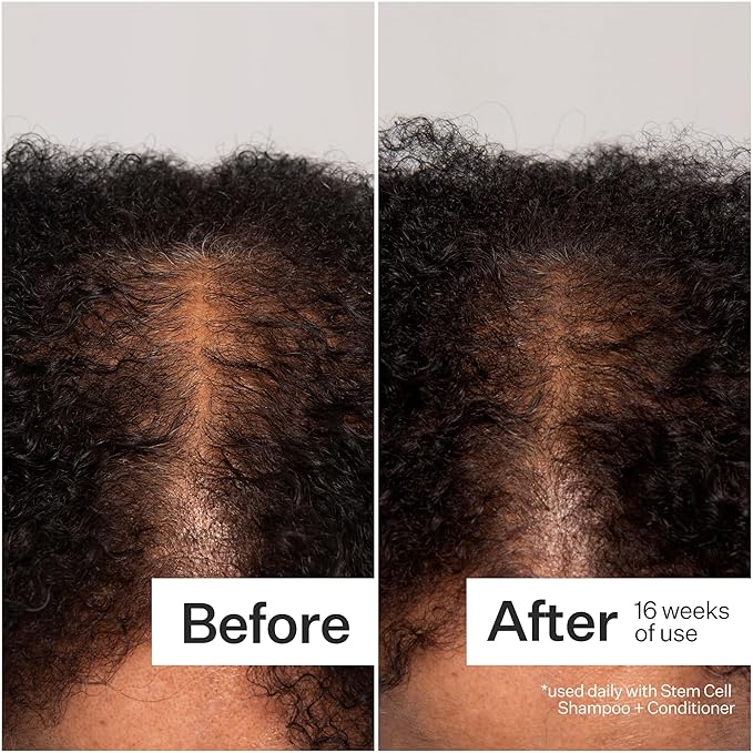 Act+Acre Cold Processed 3% Stem Cell Peptide Treatment | Boosts Hair Density | Grape Stem Cells, Peptides + Caffeine | Vegan, Fragrance-Free | 3 Fl Oz-VivaGrace Women