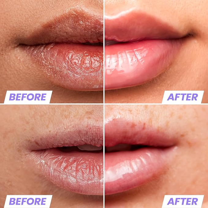 Wonderskin Lip Oil - Lip Rehab Serum Oil, Hydrating and Moisturizing Clear Serum for Dry Lips - Natural, Vegan and Non-sticky (Clear)-VivaGrace Women