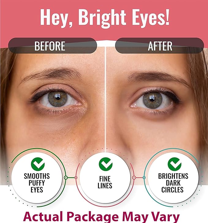 Eye Mask for Puffiness - Under Eye Patches for Dark Circles - Korean Under Eye Mask Patches for Puffy Eyes - Eye Gel Pads Depuffing Eye Brightener, Caffeine, Hydrogel & Collagen (20 Pairs)-VivaGrace Women