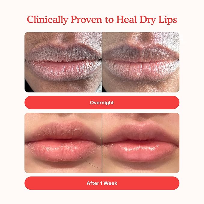 Tower 28 LipSoftie Hydrating Tinted Lip Treatment Balm, Moisturizing Lip Mask for Chapped Lips - Watermelon Kiwi Flavor, Sheer Baby Pink Gloss-VivaGrace Women