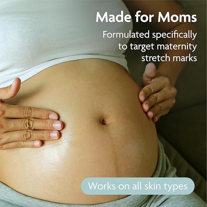 TriLASTIN Hydro-Thermal Accelerator - Moisturizer (3oz / 88ml) | Vitamin-Infused Skin Serum | Pregnancy and Postpartum Skin Care for Stretch Mark Prevention | Hypoallergenic and Paraben-Free Formula-VivaGrace Women