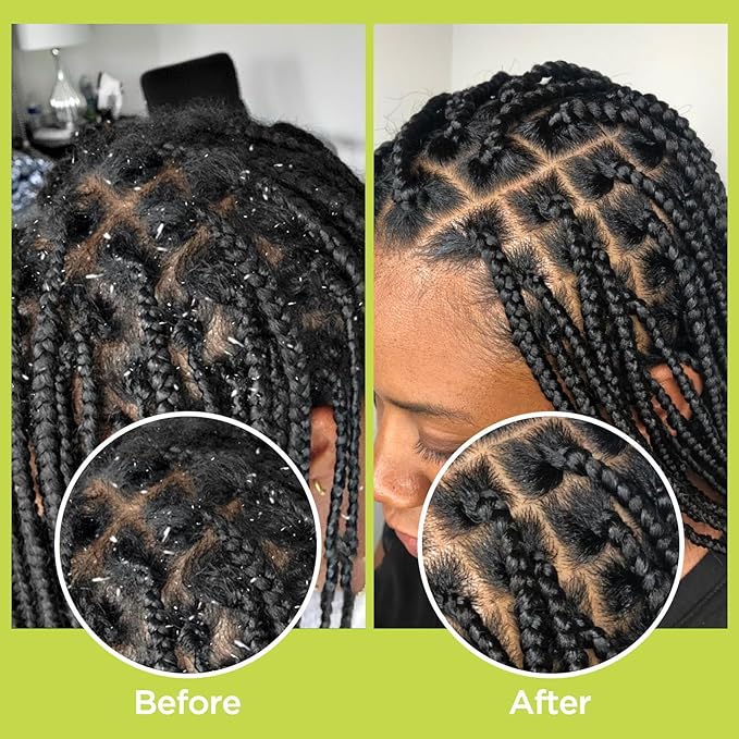 Rosemary & Apple Scalp Exfoliating Tonic - Scalp Detox Serum Deep Cleansing & Clarifying Treatment for Buildup, Dry Flaky Scalps - Soft Silicone Hair Scalps Massager Shampoo Brush for All Hair Types-VivaGrace Women