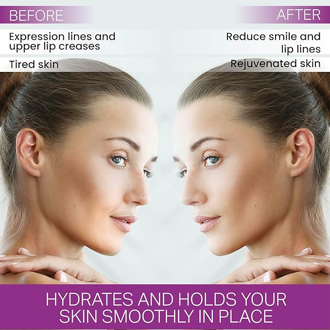 Furlesse Lip-Sticks Wrinkle Patches, Overnight Anti-Wrinkle Patches for Smile Lines, Fine Lines, and Expression Lines, Non-invasive Lip Patches, Anti-aging Skincare, 120 Patches, 30-Day Use-VivaGrace Women