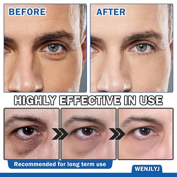 Men's Eye Cream,Hydrating Eye Cream for Men,Smooth Under Eye Cream for Dark Circles and Puffiness,Moisturizing Eye Cream Reduce Wrinkles Fine Lines & Firm Skin-VivaGrace Women