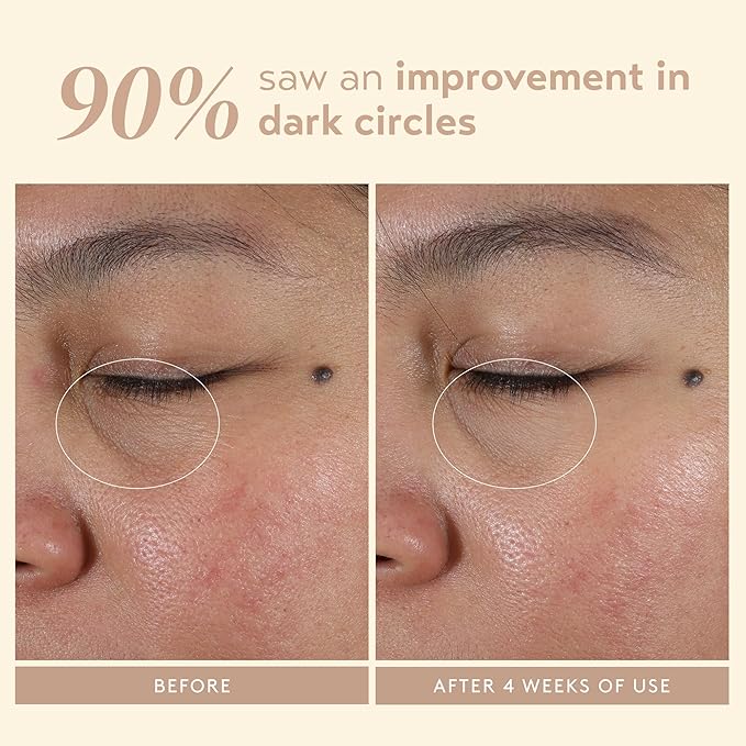 SHANI DARDEN Intensive Eye Renewal Cream, Hydrating Under Eye Cream for Dark Circles, Fine Lines, Wrinkles & Crows Feet with Niacinamide, Shea Butter & Ceramide, Crease-Free & Makeup-Ready, 0.50 fl oz-VivaGrace Women