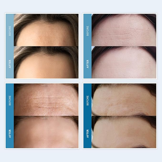 Dersie Silicone Forehead Wrinkle Patches: Reusable Anti Wrinkle Pads for Wrinkles - Overnight Use Forehead Wrinkles Treatment (3 Count (Pack of 1))-VivaGrace Women