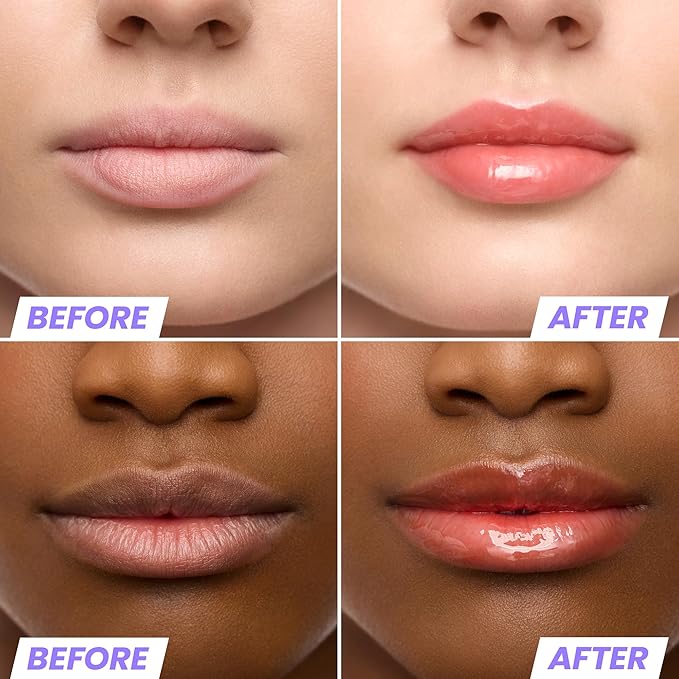 Wonderskin Lip Oil Rehab Serum - Tinted Lip Oil for Women, Hydrating, Moisturizing, and Non-Sticky Bright Red Tint Serum for Dry Lips (Flirt)-VivaGrace Women