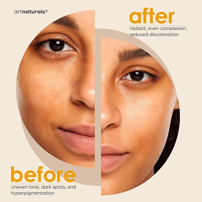 Kojic Acid Soap + African Net Sponge (2 pack X 142g Turmeric bars) Dark spot remover & Scars - Original Japanese Complex Vitamin C, Hyaluronic Acid, retinol, shea butter (Citrus)-VivaGrace Women