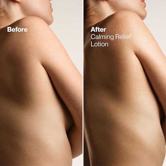 Suave Calming Relief Hand & Body Lotion for Women With Prebiotics For Sensitive Skin, Fragrance & Allergen Free, Helps Restore Skin's Moisture Barrier, 18 FL OZ, 6 Pack-VivaGrace Women