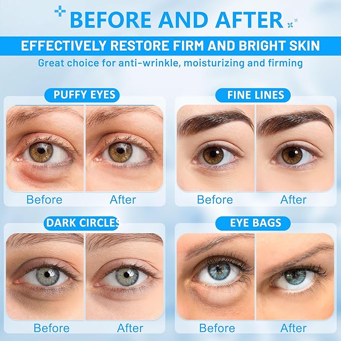 Under Eye Patches for Puffy Eyes: 30 Pairs Retinol Collagen Eye Gels Pads - Reduce Wrinkles, Puffy Eyes, Eye Bags - Skin Treatment Mask with Retinol Collagen - Anti Aging & Face Moisturizer-VivaGrace Women