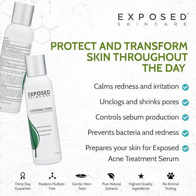 Exposed Skin Care Clearing Tonic Facial Toner with 1% Salicylic Acid and Witch Hazel for Acne Treatment – Pore Minimizing Toner to Prevent Breakouts, Reduce Redness and Balance Skin – Step 2 (4 fl oz)-VivaGrace Women
