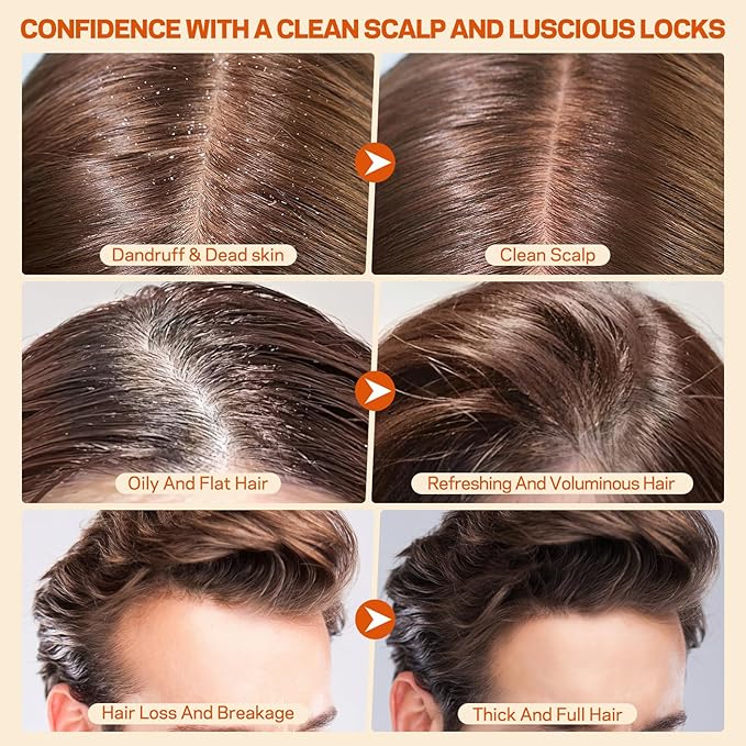 Scalp Scrub, Pumpkin Seed Oil Scalp Exfoliator With Biotin & Rosemary, Sulfate Free Scalp Detox for Itchy Scalp & Dandruff & Buildup Removal & Hair Growth, Hair Scrub with Scrubber-VivaGrace Women