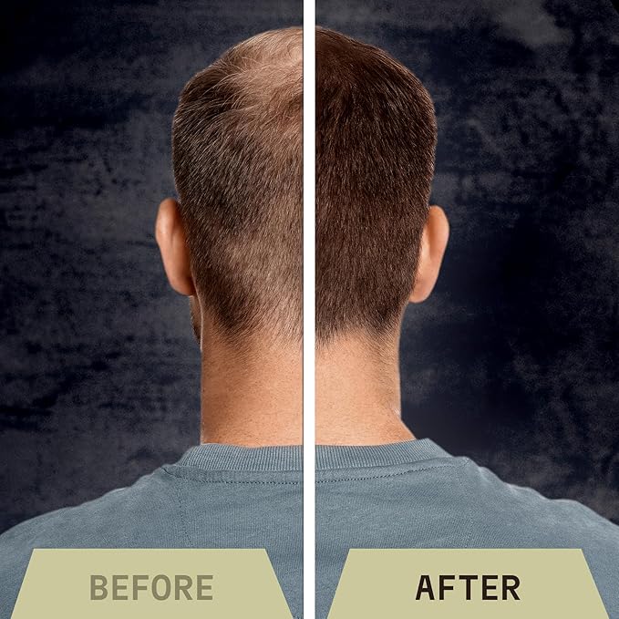 Striking Viking Hair Fibers for Thinning Hair - Building Fibers (Light Blonde) 28g - Naturally Derived Formula - Long Lasting Powder for Undetectable, Thicker Looking Results for Men & Women-VivaGrace Women