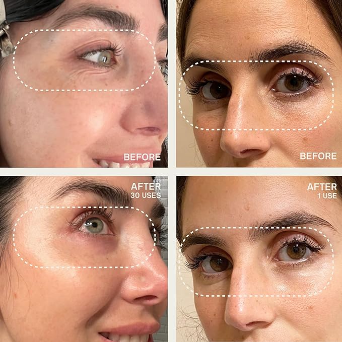 Dermaclara Silicone Facial Patches - Anti-Wrinkle Face Patches for Frown, Smile Lines & Forehead, Reusable Overnight Silicone Wrinkle Pads, Up to 30 Uses - 4 Under Eye Patches & 1 Forehead Patch-VivaGrace Women