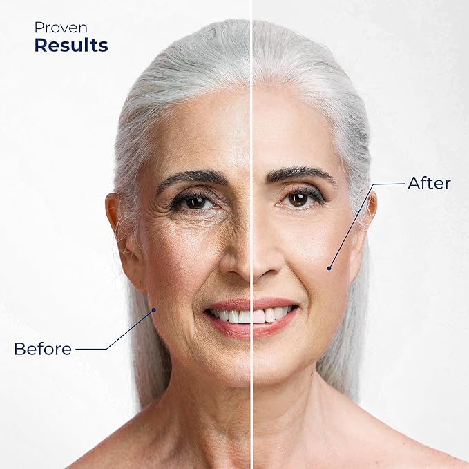 Retinol Eye Cream for Puffiness and Bags Under Eyes | Anti-Aging, Wrinkles & Fine Lines Treatment | Eye Cream for Wrinkles w/Advanced Tightening & Firming Formula | Eye Cream Anti Aging-VivaGrace Women