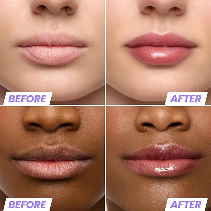 Wonderskin Lip Oil Rehab Serum - Tinted Lip Oil, Hydrating, Moisturizing, and Non-Sticky Deep Red Tint Serum for Dry Lips (Honey)-VivaGrace Women