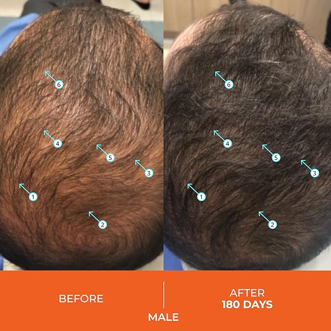 DS Labs Revita Hair Vitamin Gummies - Thickening & Strengthening Hair Supplement with Biotin, Zinc, Iron, Magnesium, Vitamin D & Melatonin, Fuller, Healthier-Looking Hair, Vegan & Gluten-Free-VivaGrace Women