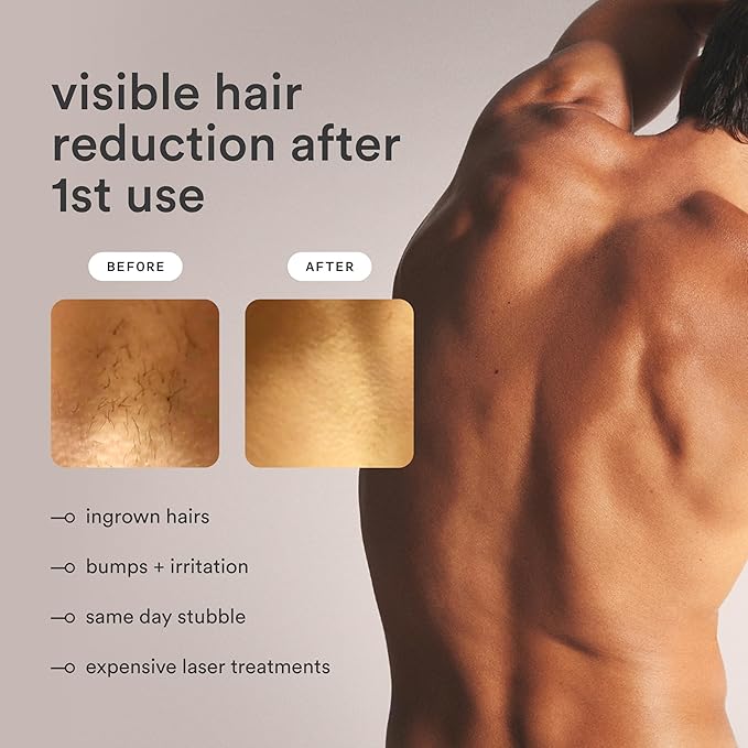 NEW Nood™ Flasher Pro — IPL Laser Hair Removal Device for Women & Men with Sapphire Cooling — Pain-free & Permanent, Visible Results After First Use & Works Everywhere Hair Grows — Gloss White-VivaGrace Women