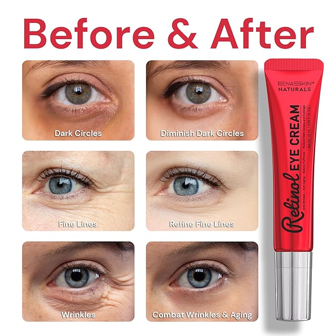 Retinol Under Eye Cream for Dark Circles & Puffiness, Daily Wrinkle Cream, Anti Aging Line Smoothing Skin Care Treatment for Women and Men, 1.7 fl. oz-VivaGrace Women