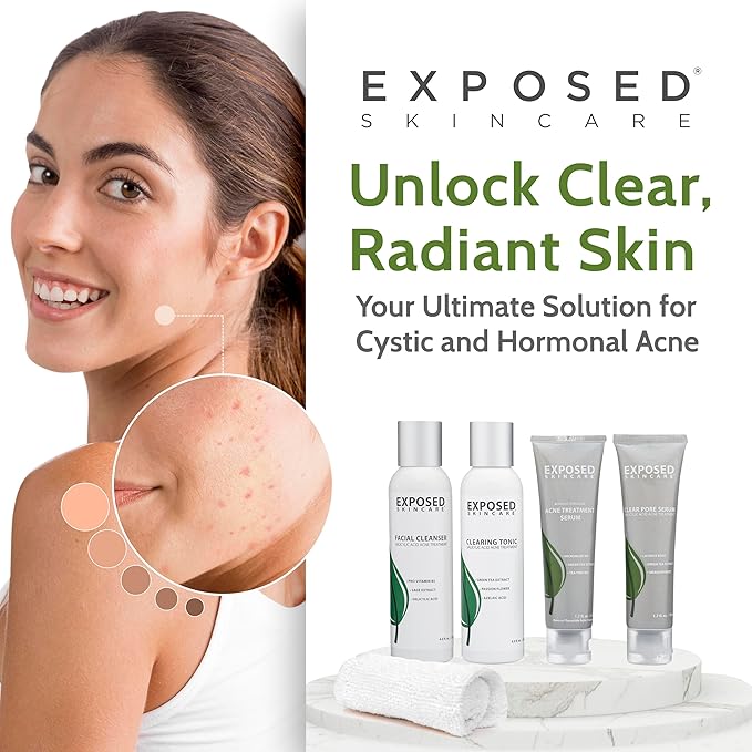 Exposed Skin Care Basic Acne Treatment Kit - Includes Salicylic Acid Face Wash, Clearing Tonic, Treatment Serum with Benzoyl Peroxide, Clear Pore Serum - Natural Acne Solution for All Skin Types-VivaGrace Women