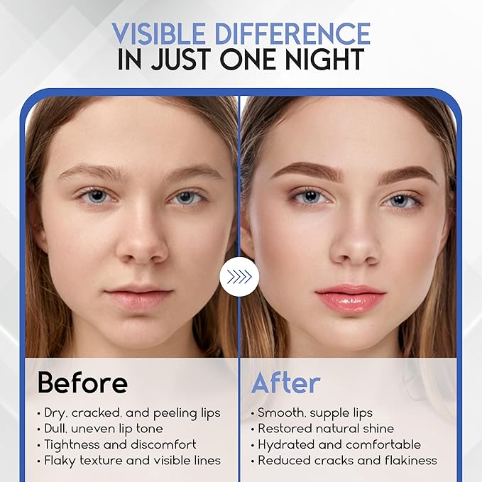 Lip Mask Overnight with Hyaluronic Acid & Collagen, Lip Sleeping Mask for Dry Cracked Lips, Moisturizing, Hydrating, Exfoliating Night Treatment for Lip Care (Berry)-VivaGrace Women