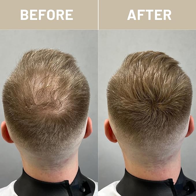 VOLLUCK Hair Fibers for Thinning Hair, Instant Coverage Hair Building Fibers for Women and men, Natural Hair Powder for Conceal Hair Loss 28 g (Black)-VivaGrace Women