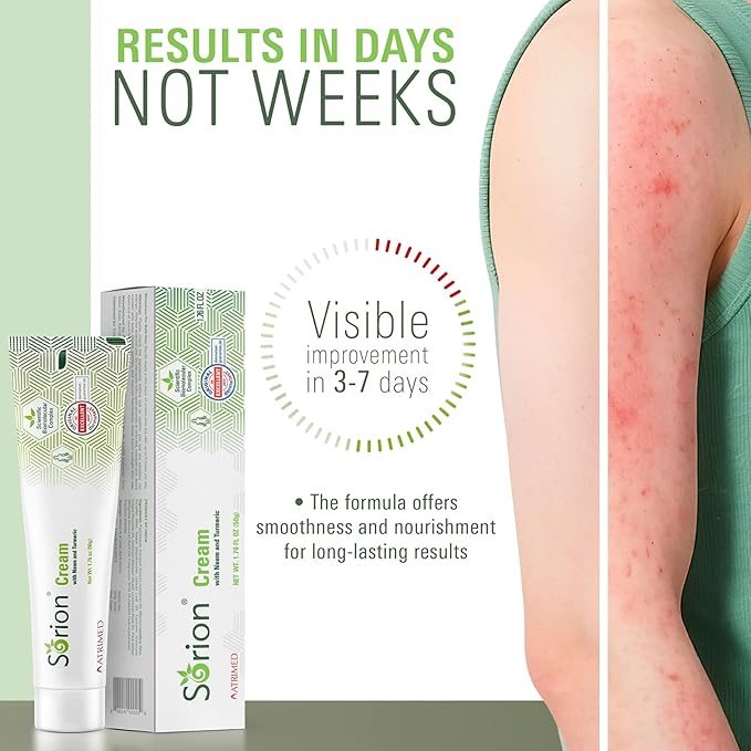 Sorion Cream - Herbal Moisturizer for Dry, Itchy, Flaky Skin with Coconut Oil, Neem, Turmeric and Pala Indigo Plant Skincare-VivaGrace Women