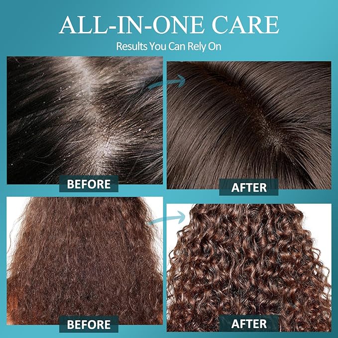 Scalp Scrub, Biotin 2-in-1 Scalp Exfoliator Scrub Clarifying Detox Shampoo with 3% Salicylic Acid & Tea Tree for Dandruff, Build Up, Itchy Scalp, Oily Hair & Dry Scalp Treatment with Scalp Massager-VivaGrace Women