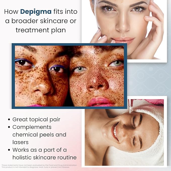 GlocalCare Depigma Support Reduction of Hyperpigmentation, Melasma & Dark Spots with Glutathione, Polypodium Leucotomos, Grape Seed & Marigold Extract-VivaGrace Women