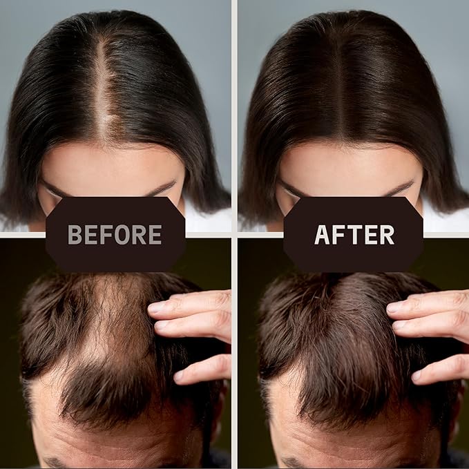 Striking Viking Hair Fibers for Thinning Hair, Dark Brown (28g) - Long Lasting, Undetectable Natural Building Powder for Thicker Looking Results, Men & Women-VivaGrace Women