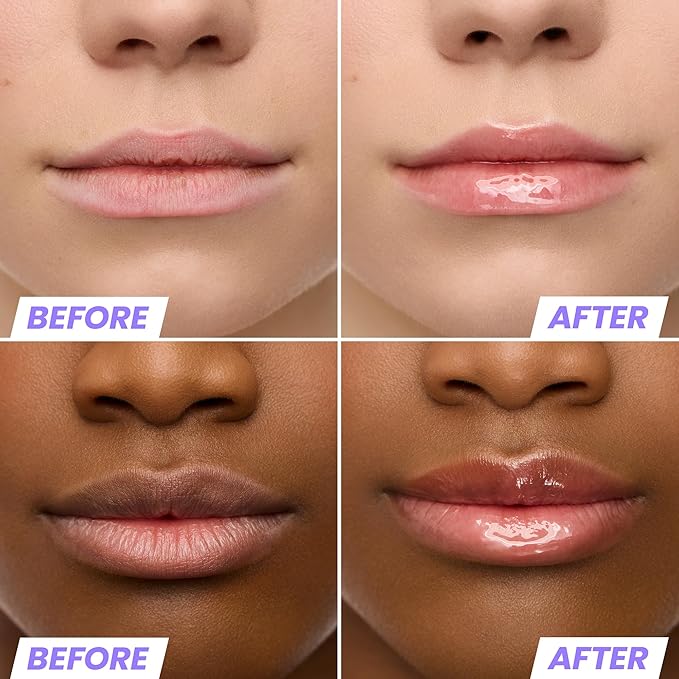 Wonderskin Lip Oil Rehab Serum - Tinted Lip Oil, Hydrating, Moisturizing, and Non-Sticky Coral Pink Tint Serum for Dry Lips (Lover)-VivaGrace Women