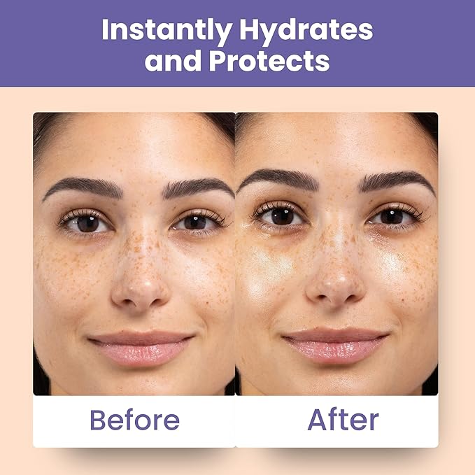 Patchology Skin Remedy Calm & Protect Micro Mist – Hydrating Facial Spray with Ectoin, Probiotics & Botanical Blend - Fragrance Free - Refines Pores & Leaves a Fresh Glow - 80 mL-VivaGrace Women