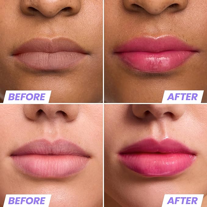 Wonderskin Lip Oil Rehab Serum - Color Changing Lip Oil from Clear to Pink - PH-activated, Non-sticky & Hydrating Tinted Serum for Dry Lips (Kissed)-VivaGrace Women