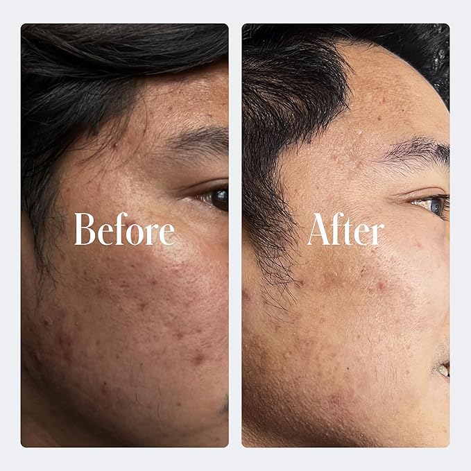 Geologie Retinol Anti-Aging Face Cream | Enhanced .2% Retinol Formula for Effective Results | Reduce Fine Lines & Wrinkles | Protect & Repair Skin With Hyaluronic Acid & Niacinamide | For Men & Women-VivaGrace Women