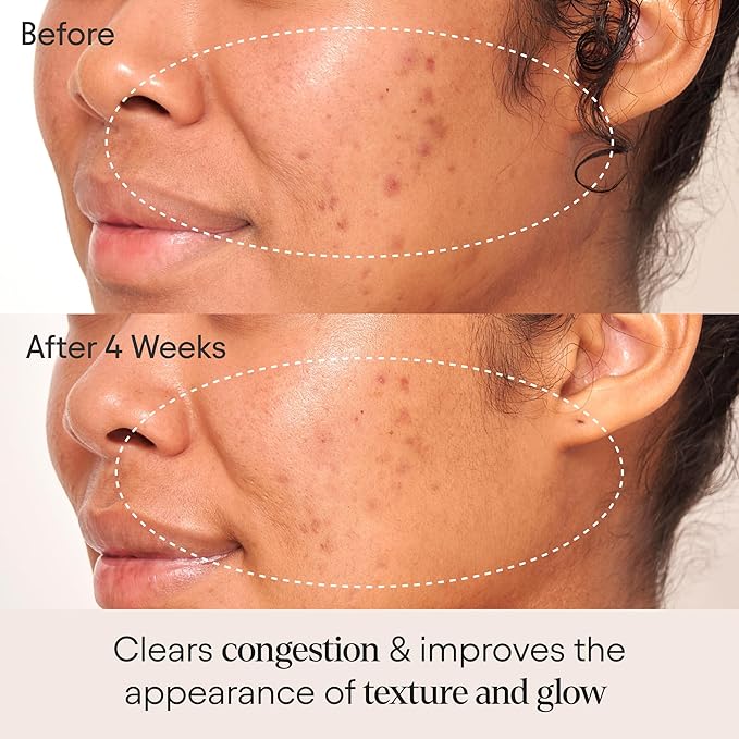 ALPYN Clarifying Facial Oil with Retinol & Pink Algae | Clear Congestion, Smooth Fine Lines, Improve Texture & Glow | 1 Fl Oz / 30 ml-VivaGrace Women