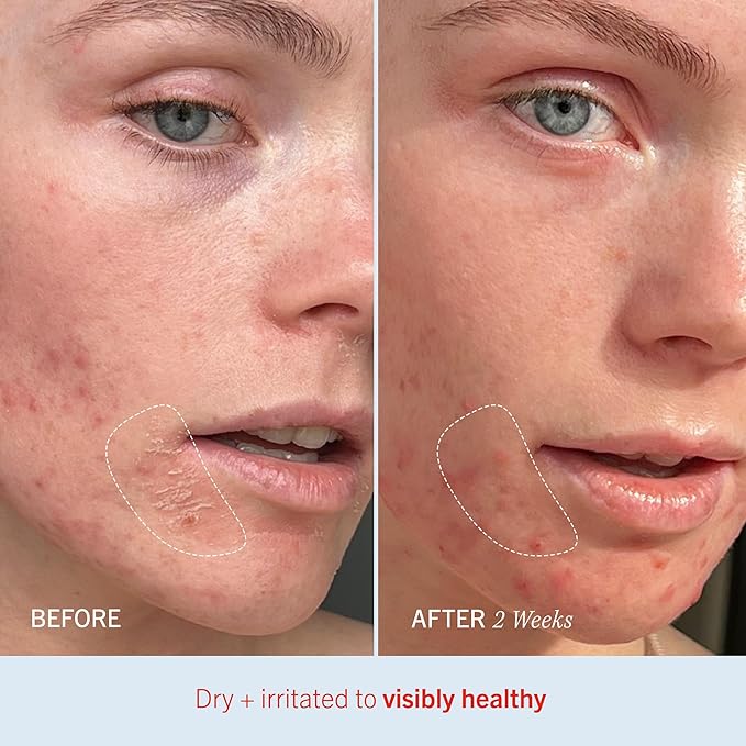 First Aid Beauty - Ultra Repair Cream, Intense Hydration Whipped Colloidal Oatmeal, Clinically Proven to Strengthen Skin Barrier in 7 Days & Helps Relieve Eczema, Luxury Face & Body Moisturizer, 8 oz-VivaGrace Women