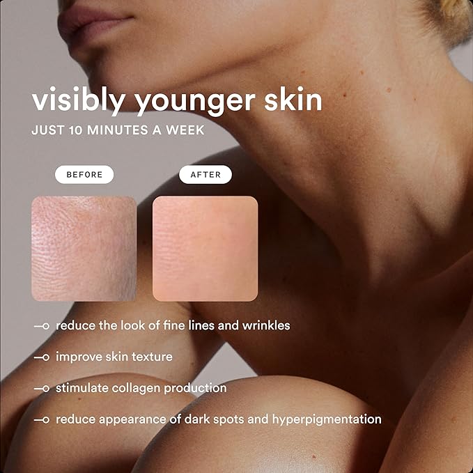 NEW Nood™ Flasher Pro — IPL Laser Hair Removal Device for Women & Men with Sapphire Cooling — Pain-free & Permanent, Visible Results After First Use & Works Everywhere Hair Grows — Gloss White-VivaGrace Women