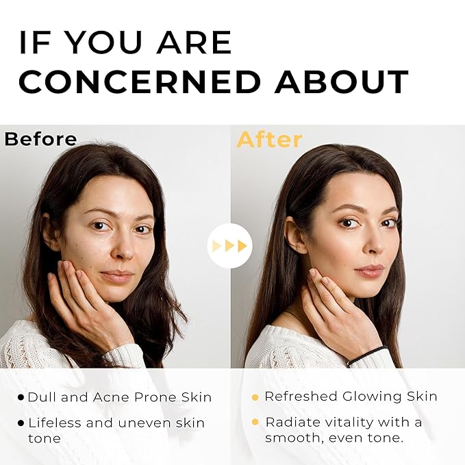 Italian White Truffle Spray Serum - Vegan Skin Care - Face Mist Hydrating Spray with Avocado & White Truffles - Face Serum for Radiant Skin - 3.38 Fl Oz-VivaGrace Women